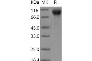Western Blotting (WB) image for Platelet Derived Growth Factor Receptor beta (PDGFRB) (Active) protein (His tag) (ABIN7197403)