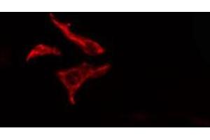 ABIN6278571 staining  HT29 cells by IF/ICC. (FZD7 anticorps  (C-Term))