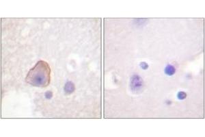 Immunohistochemistry analysis of paraffin-embedded human brain tissue, using ADD1 (Ab-726) Antibody.