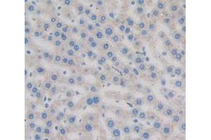 Figure. (Transferrin anticorps  (AA 380-565))