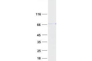 Validation with Western Blot