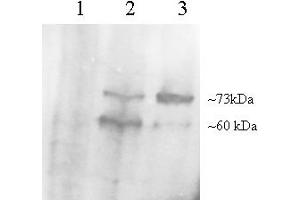 Western Blotting (WB) image for anti-Proprotein Convertase Subtilisin/kexin Type 9 (PCSK9) (AA 679-692) antibody (ABIN296977) (PCSK9 anticorps  (AA 679-692))