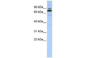 C14ORF21 antibody used at 1 ug/ml to detect target protein. (C14orf21 anticorps  (Middle Region))