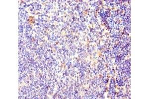 Immunohistochemistry of paraffin-embedded human lymphoid tissue using ABIN7170927 at dilution of 1:100 (OXCT1 anticorps  (AA 40-520))