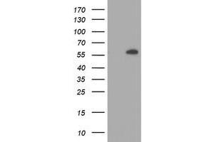 Western Blotting (WB) image for anti-V-Akt Murine Thymoma Viral Oncogene Homolog 1 (AKT1) antibody (ABIN1496554)