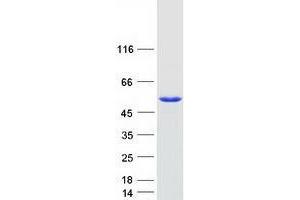 Validation with Western Blot