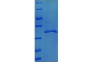 SDS-PAGE (SDS) image for Transforming Growth Factor, beta 1 (TGFB1) (AA 260-373) protein (His-SUMO Tag) (ABIN5710484)