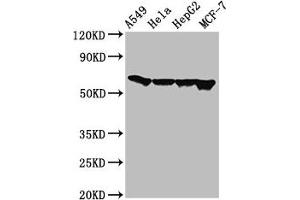 Western Blot Positive WB detected in: A549 whole cell lysate, Hela whole cell lysate, HepG2 whole cell lysate, MCF-7 whole cell lysate All lanes: FZD10 antibody at 3 μg/mL Secondary Goat polyclonal to rabbit IgG at 1/50000 dilution Predicted band size: 66 kDa Observed band size: 66 kDa (FZD1 anticorps  (AA 125-225))