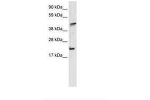 Image no. 1 for anti-IKAROS Family Zinc Finger 5 (Pegasus) (IKZF5) (N-Term) antibody (ABIN6735950)