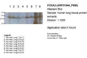 Sample Type: Human lung tissue protein extractsPrimary Dilution: 1:1000Secondary (Anti-Rabbit HRP sc-2004) Dilution: 1:1000 (FOXA2 anticorps  (Middle Region))