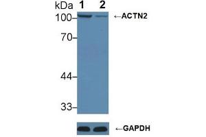 Western blot analysis of (1) Wild-type HeLa cell lysate, and (2) ACTN2 knockout HeLa cell lysate, using Rabbit Anti-Mouse ACTN2 Antibody (1 µg/ml) and HRP-conjugated Goat Anti-Mouse antibody (