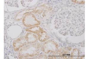 Immunoperoxidase of monoclonal antibody to PI15 on formalin-fixed paraffin-embedded human kidney.