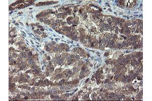 Image no. 3 for anti-Crystallin, Zeta, Homolog antibody (ABIN1497658) (CRYZL1 anticorps)