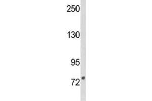 Western blot analysis of DGCR8 antibody and NCI-H460 lysate.