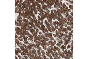 Immunohistochemical staining (Formalin-fixed paraffin-embedded sections) of human liver shows strong cytoplasmic positivity in hepatocytes. (Glucose-6-Phosphate Dehydrogenase anticorps  (AA 43-154))