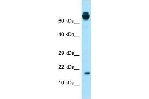 Western Blotting (WB) image for anti-Vitamin K-dependent protein C (PROC) (Middle Region) antibody (ABIN2774395) (PROC anticorps  (Middle Region))