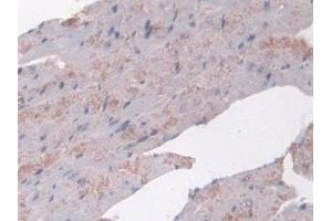 Detection of NAT1 in Mouse Heart Tissue using Polyclonal Antibody to N-Acetyltransferase 1 (NAT1)