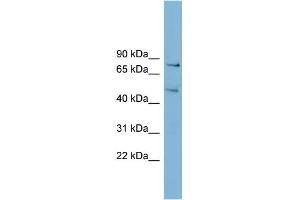 WB Suggested Anti-BOP1 Antibody Titration:  0. (BOP1 anticorps  (N-Term))