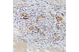 Immunohistochemistry of paraffin-embedded human liver using ENTPD1/CD39 Rabbit pAb (ABIN1679729, ABIN3018088, ABIN3018089 and ABIN6220354) at dilution of 1:25 (40x lens). (CD39 anticorps  (AA 1-180))