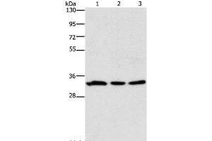 Western Blot analysis of 293T and Human colon cancer tissue, 231 cell using GPA33 Polyclonal Antibody at dilution of 1:600 (GPA33 anticorps)