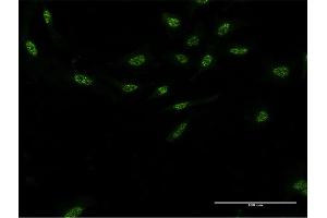 Immunofluorescence of monoclonal antibody to AIPL1 on HeLa cell. (AIPL1 anticorps  (AA 1-384))