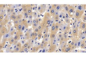 Detection of Bid in Human Liver Tissue using Polyclonal Antibody to BH3 Interacting Domain Death Agonist (Bid) (BID anticorps  (AA 1-195))