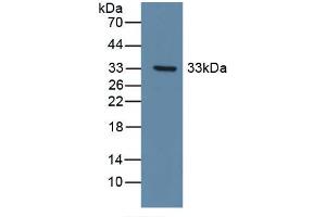 Detection of Recombinant DDR1, Human using Polyclonal Antibody to Discoidin Domain Receptor Family, Member 1 (DDR1)