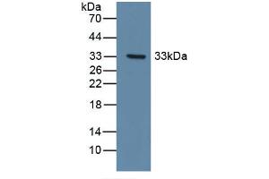 Detection of Recombinant DDR1, Human using Polyclonal Antibody to Discoidin Domain Receptor Family, Member 1 (DDR1) (DDR1 anticorps  (AA 568-829))