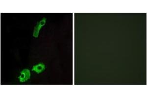 Immunofluorescence analysis of HeLa cells, using GPR151 Antibody. (GPR151 anticorps  (AA 276-325))