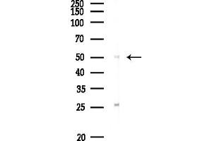 Western blot analysis of lysates from Rat liver, using PPP2R2B Antibody at 1/1000 dilution.