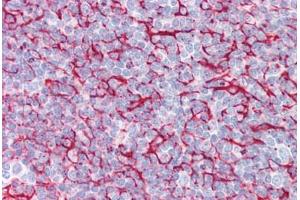 Anti-BRAF antibody IHC staining of human tonsil.