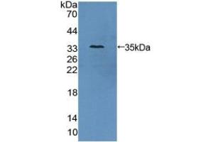 Western blot analysis of recombinant Human AZIN1. (Antizyme Inhibitor 1 anticorps  (Lys290))