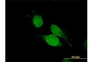 Immunofluorescence of purified MaxPab antibody to NCK1 on HeLa cell. (NCK1 anticorps  (AA 1-377))