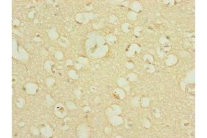 Immunohistochemistry of paraffin-embedded human brain tissue using ABIN7159895 at dilution of 1:100