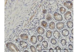 Image no. 1 for anti-Interleukin 37 (IL37) (AA 1-219) antibody (ABIN599218) (IL-37 anticorps  (AA 1-219))