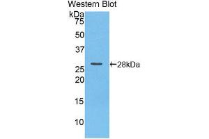 Western blot analysis of the recombinant protein. (PNPLA2 anticorps  (AA 481-702))