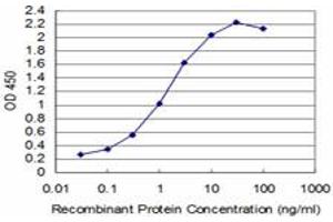 Detection limit for recombinant GST tagged T is approximately 0. (T Brachyury Protein (AA 222-320) anticorps)