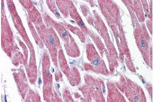 Human Heart: Formalin-Fixed, Paraffin-Embedded (FFPE)