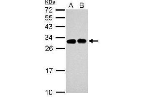 WB Image Sample (30 ug of whole cell lysate) A: Jurkat B: Raji 12% SDS PAGE antibody diluted at 1:5000 (SLC25A11 anticorps)