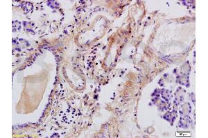 Formalin-fixed and paraffin embedded rat pancreas tissue labeled with Anti-Tenascin C/Tn-C Polyclonal Antibody, Unconjugated (ABIN736761) at 1:200 followed by conjugation to the secondary antibody and DAB staining