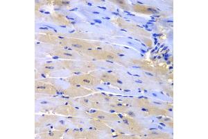 Immunohistochemistry of paraffin-embedded mouse heart using CUL2 antibody (ABIN5975808) at dilution of 1/200 (40x lens). (Cullin 2 anticorps)