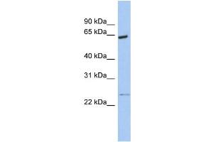 WB Suggested Anti-PCTK1 Antibody Titration:  0. (CDK16 anticorps  (N-Term))