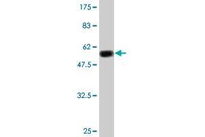 Western Blot detection against Immunogen (51. (TK1 anticorps  (AA 1-234))