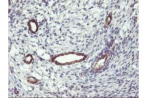 Image no. 2 for anti-Family with Sequence Similarity 84, Member B (FAM84B) antibody (ABIN1498212) (FAM84B anticorps)