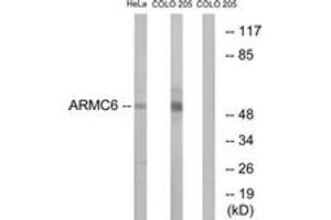 Western blot analysis of extracts from HeLa/COLO cells, using ARMC6 Antibody. (ARMC6 anticorps  (AA 431-480))