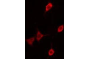 ABIN6276361 staining  A2780 cells by IF/ICC. (CDKN1B anticorps  (Internal Region))
