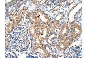 Image no. 1 for anti-Solute Carrier Family 39 (Zinc Transporter), Member 6 (SLC39A6) (AA 26-75) antibody (ABIN205014)