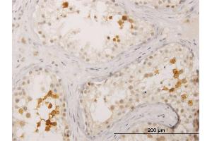 Immunoperoxidase of monoclonal antibody to BOLL on formalin-fixed paraffin-embedded human testis. (BOLL anticorps  (AA 185-283))