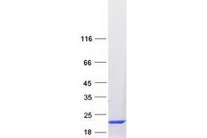 Validation with Western Blot