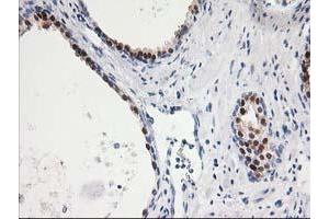 Immunohistochemical staining of paraffin-embedded Human prostate tissue using anti-SMS mouse monoclonal antibody. (SMS anticorps)